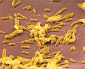 Bacilo tipo de enfermedades bacterianas en plantas