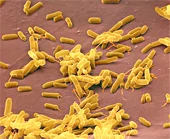 Enfermedades de las plantas 16 Bacilo tipo de enfermedades bacterianas en plantas